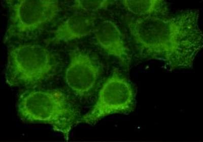 KRT18 / CK18 / Cytokeratin 18 Antibody