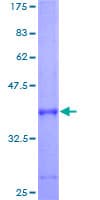 Human HBG1 / Fetal Hemoglobin Protein (Recombinant GST, N-terminus)