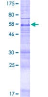 Human MBOAT1 Protein (Recombinant GST)