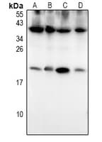 S100P Antibody