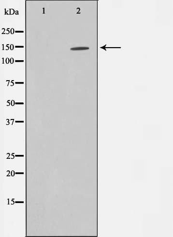 Polyclonal Rabbit anti-Human ZMYND8 / RACK7 Antibody (IF, WB)