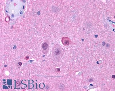 IHC-plus™ NPY5R Antibody (Cytoplasmic Domain)