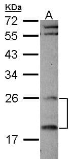 RGS4 Antibody (aa1-205)