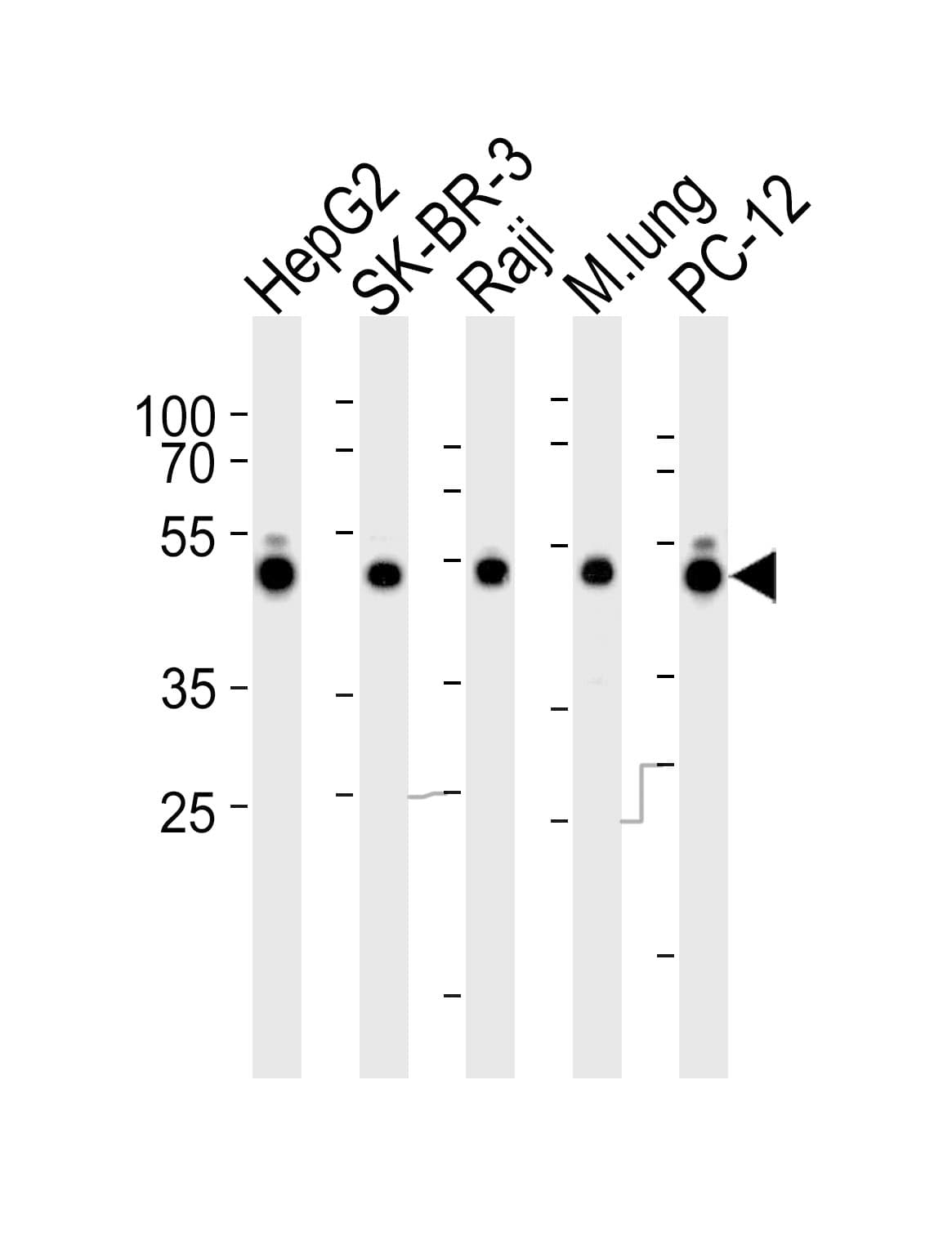 DNAJA1 / HDJ2 Antibody (aa379-414)