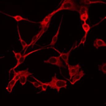 Polyclonal Rabbit anti-Human ABHD6 Antibody (IF, WB)