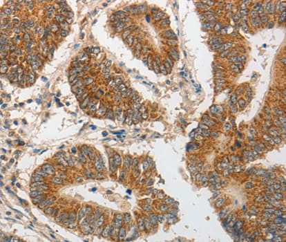 PIBF1 / PIBF Antibody