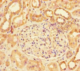 LHB / Luteinizing Hormone Antibody