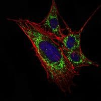 Monoclonal Mouse anti-Human KLHL11 Antibody (clone 1B9A8, IF, WB)
