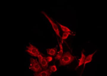 VPAC2 / VIPR2 Antibody