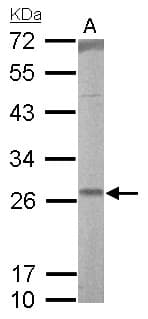Polyclonal Rabbit anti-Human RALA / RAL Antibody (aa1-206, WB)