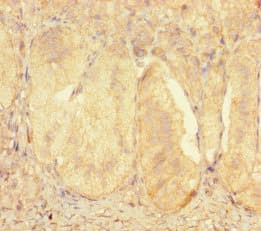 Polyclonal Rabbit anti-Human ZNF175 Antibody (WB)