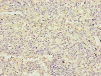 FBXL5 / FBL5 Antibody