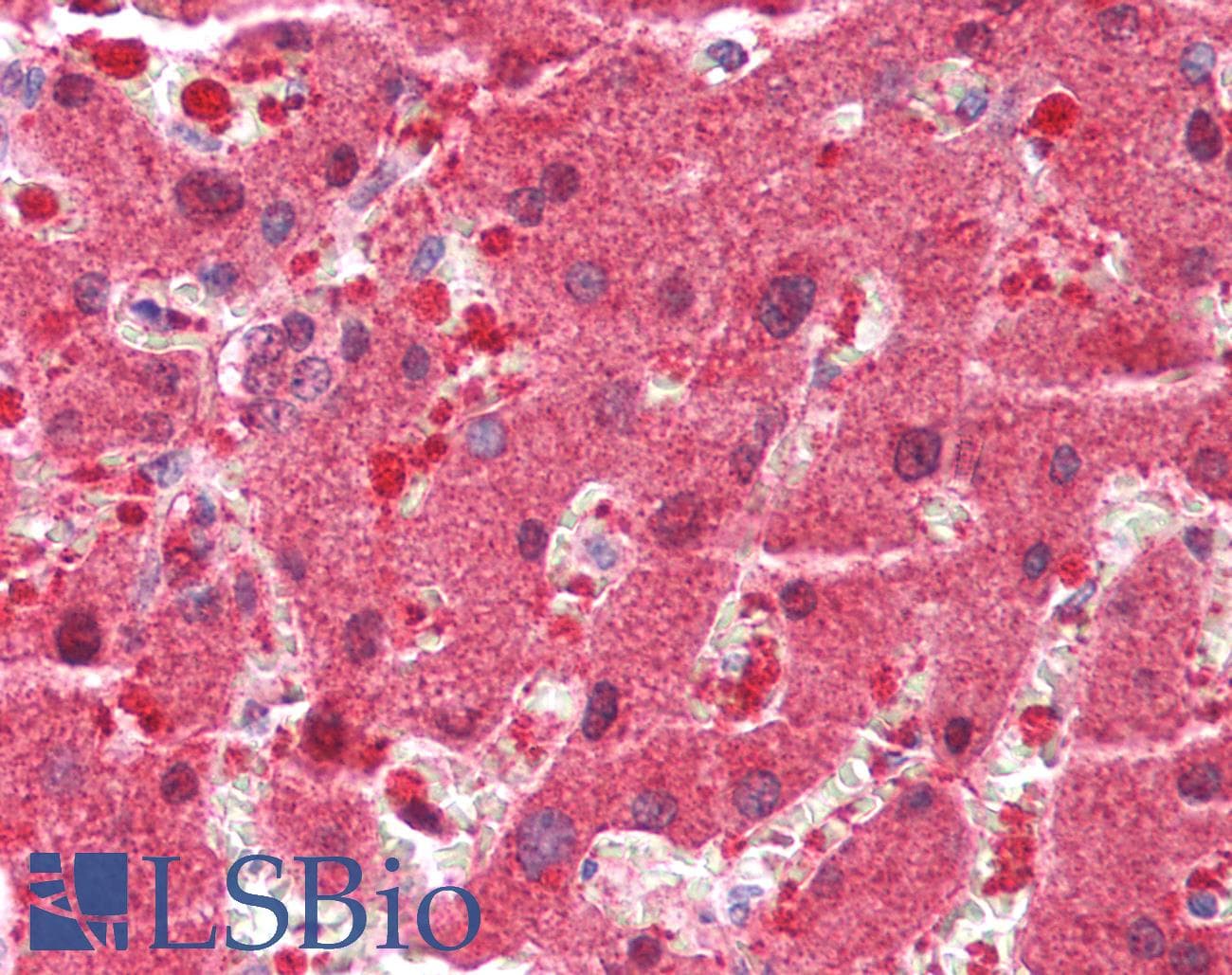 IHC-plus™ GAMT Antibody