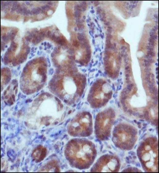 IDH2 Antibody (aa375-452)