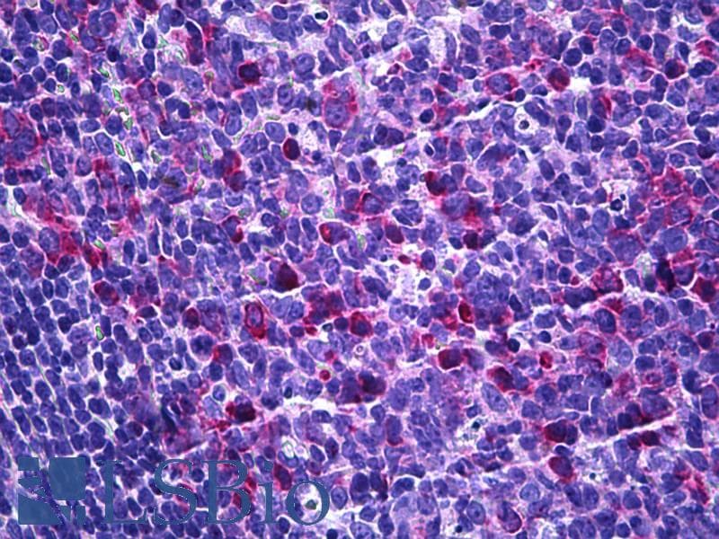 IHC-plus™ EIF3D Antibody (aa101-150)