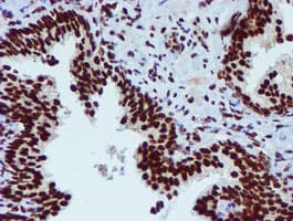 Monoclonal Mouse anti-Human PADI4 / PAD4 Antibody (clone OTI4H5, IHC, IF, WB)