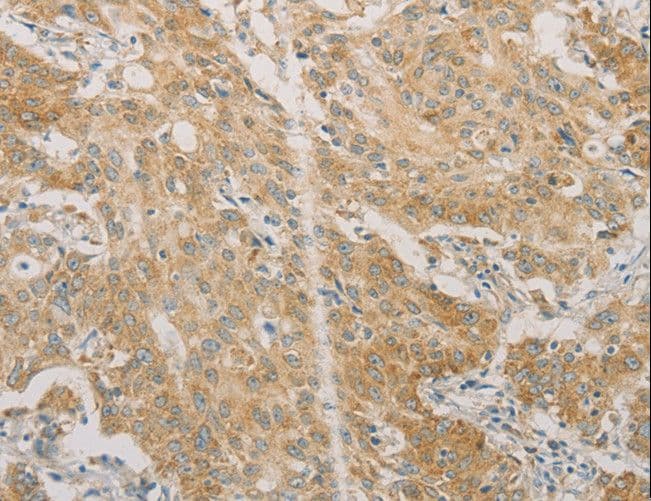Polyclonal Rabbit anti-Human ACSL4 / FACL4 Antibody (IHC, WB)