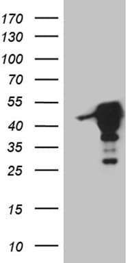 MAGEB4 Antibody (aa1-193, clone OTI3A6)