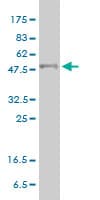 PPARD / PPAR Delta Antibody (clone 4E3-1B11)