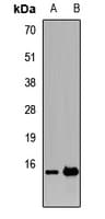 TRAPPC2 / SEDL Antibody