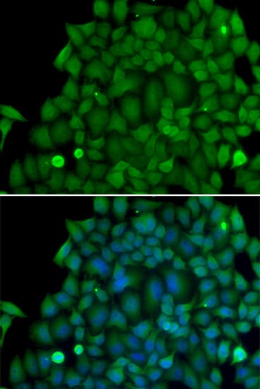 Polyclonal Rabbit anti-Human SNAI2 / SLUG Antibody (IHC, IF, WB)