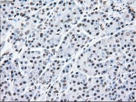MAP2K2 / MKK2 / MEK2 Antibody (clone OTI8G6)