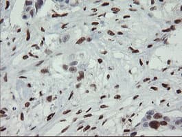 Monoclonal Mouse anti-Human MAFB Antibody (clone OTI2A6, IHC, WB)