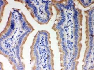 ITPR3 Antibody