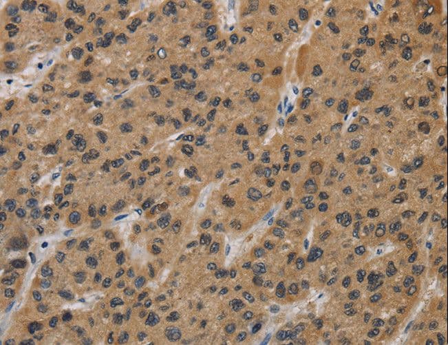 Polyclonal Rabbit anti-Human INPPL1 / SHIP2 Antibody (IHC)