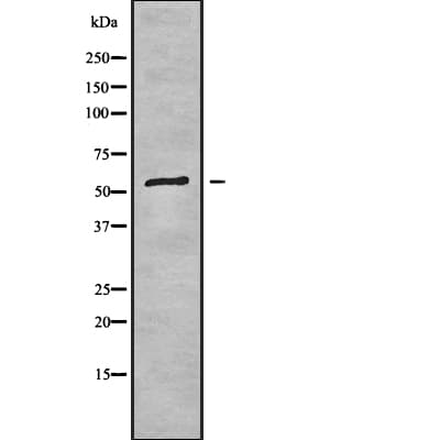 USP14 Antibody