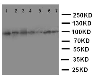 ADAMTS1 Antibody (aa956-968)