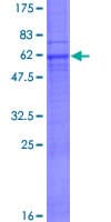 Human MOGAT3 Protein (Recombinant GST)