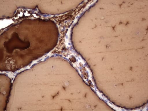 TG / Thyroglobulin Antibody (aa20-358, clone OTI8D4)