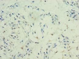 HDAC11 Antibody (aa1-347)