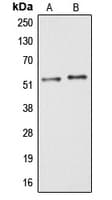 Polyclonal Rabbit anti-Human ARMC6 Antibody (C-Terminus, IF, WB)