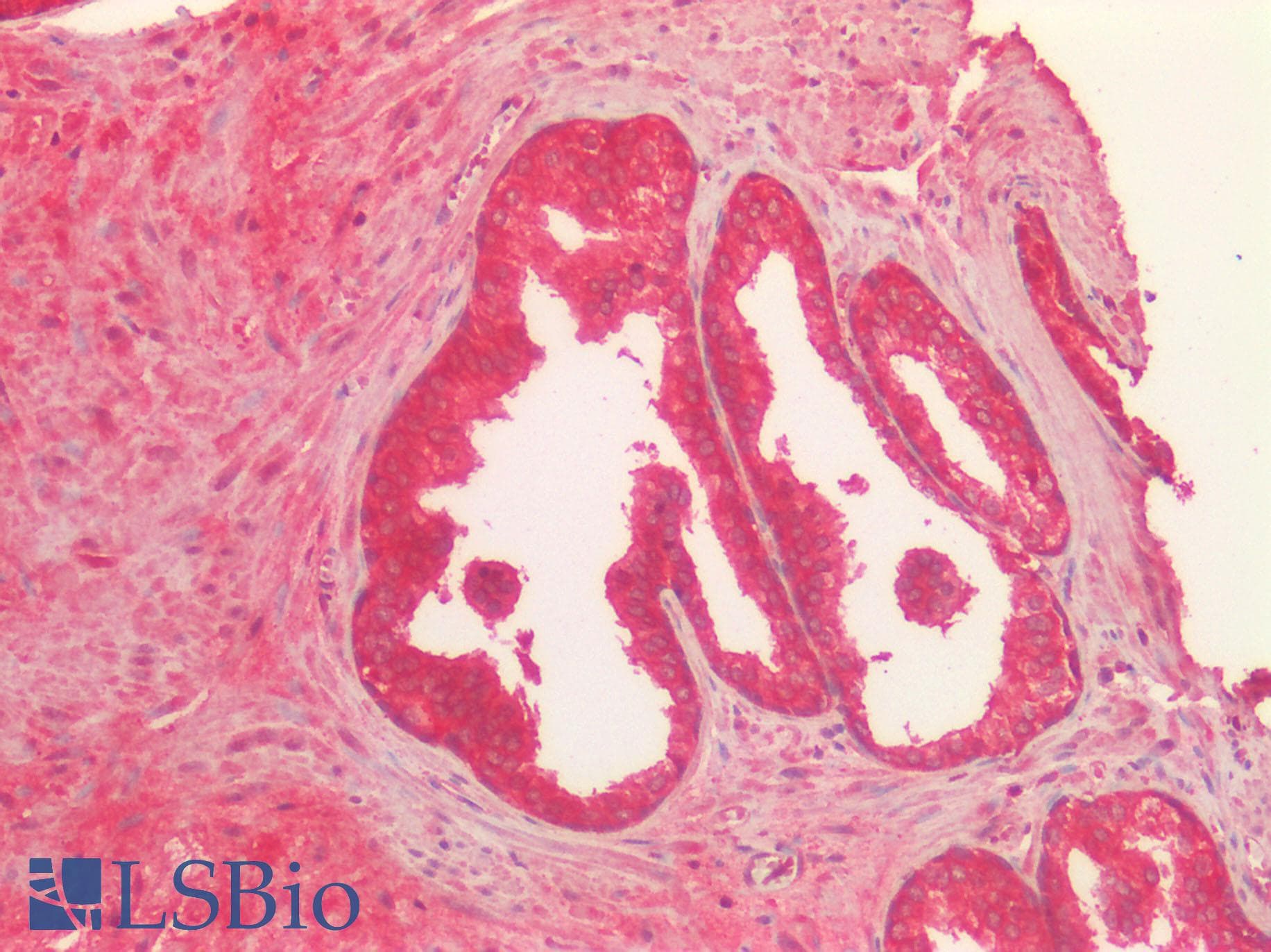 VPS4A Antibody