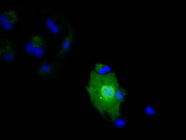 Monoclonal Mouse anti-Human IL36A Antibody (clone OTI3A2, IF, WB)