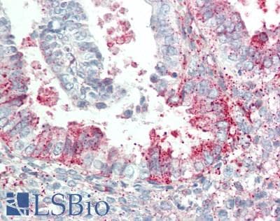 SLC39A5 / ZIP5 Antibody (N-Terminus)