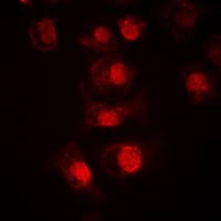 MLX / TCFL4 Antibody (Internal)