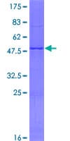 Human MBD3L1 Protein (Recombinant GST)