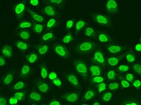 POLR2J Antibody