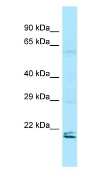RAP2 Antibody (aa31-80)