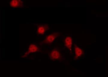 AP-1 / JUND Antibody (phospho-Ser255)