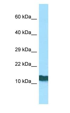 RPL36AL Antibody (C-Terminus)