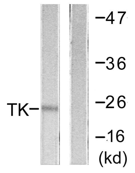 Polyclonal Rabbit anti-Human TK1 / TK / Thymidine Kinase Antibody (aa1-50, IHC, IF, WB)