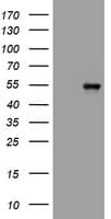 Vimentin Antibody (clone OTI5C10)
