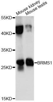 BRMS1 Antibody