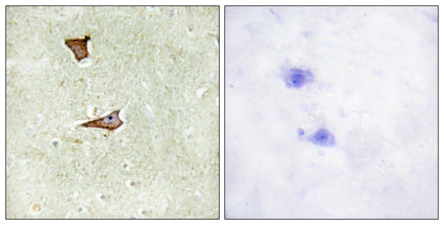 IGF2R / CD222 Antibody (phospho-Ser2409)