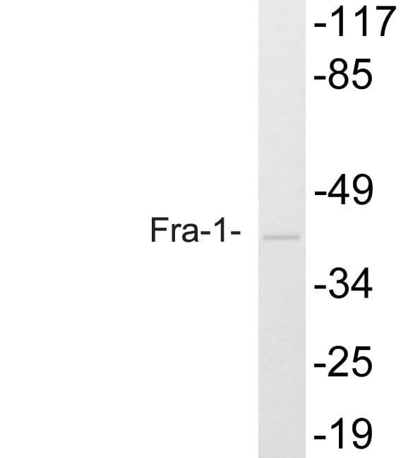 FRA-1 / FOSL1 Antibody (Asp134)