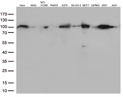 Monoclonal Mouse anti-Human EWSR1 / EWS Antibody (clone OTI3F6, aa256-447, IHC, IF, WB)